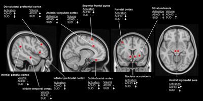 Methylphenidate as a treatment option for substance use disorder: a transdiagnostic perspective